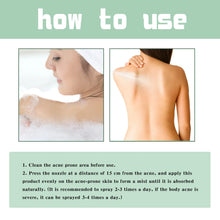 Load image into Gallery viewer, Jaysuing Repair Back Acne Care Spray Shoulder Pimple Remove Fade Acne Scar Soothe Body Nourish Skin Cleansing Body Pimples Spray