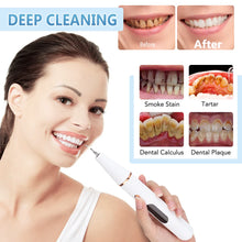 Load image into Gallery viewer, Ultrasonic Dental Calculus Scaler Teeth Cleaner Smoke Stains Plaque Tartar Dental Stone Removal Teeth Cleaning Whitening Tools