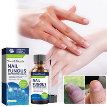 Load image into Gallery viewer, Maximum Strength Nail Fungus Repairing Liquid Removal Infected Thickening Bright Fungal Treatment Medication Soft Hand Foot Care