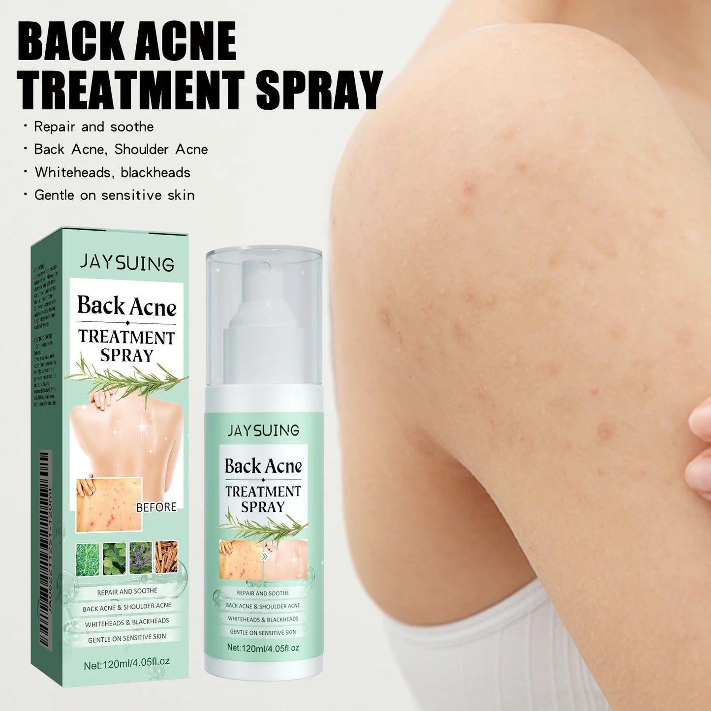 Jaysuing Repair Back Acne Care Spray Shoulder Pimple Remove Fade Acne Scar Soothe Body Nourish Skin Cleansing Body Pimples Spray
