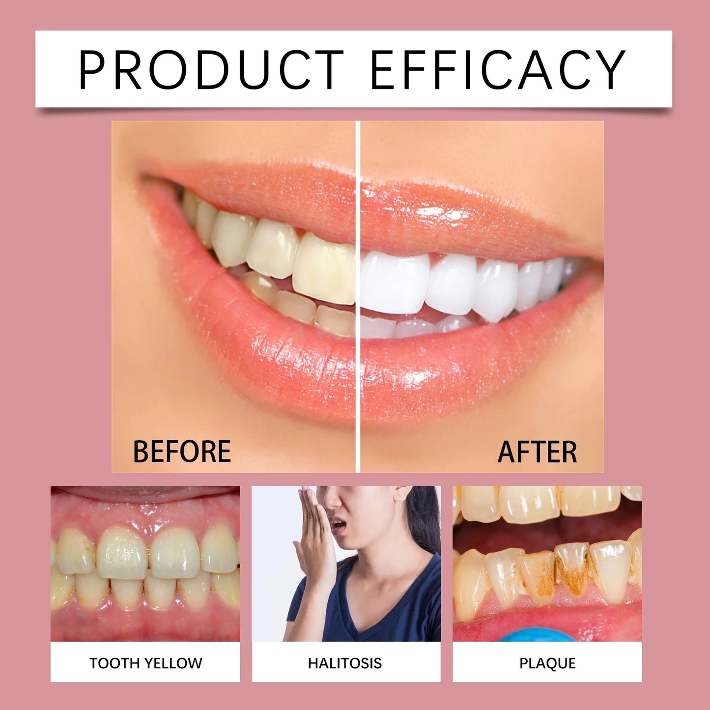 120g Probiotic Toothpaste SP-7 Whitens Teeth Removes Yellow Stains Tooth Whitening Agent Oral Hygiene Cleans and Freshens Breath