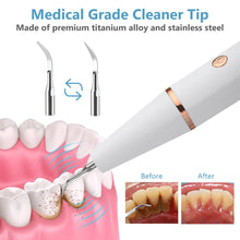 Load image into Gallery viewer, Ultrasonic Dental Calculus Scaler Teeth Cleaner Smoke Stains Plaque Tartar Dental Stone Removal Teeth Cleaning Whitening Tools