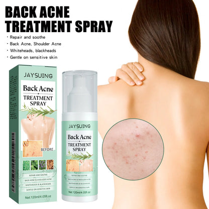 Jaysuing Repair Back Acne Care Spray Shoulder Pimple Remove Fade Acne Scar Soothe Body Nourish Skin Cleansing Body Pimples Spray