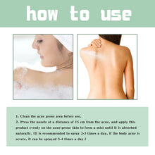 Load image into Gallery viewer, Jaysuing Repair Back Acne Care Spray Shoulder Pimple Remove Fade Acne Scar Soothe Body Nourish Skin Cleansing Body Pimples Spray
