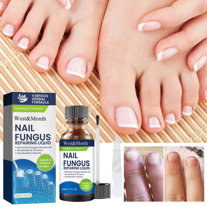 Maximum Strength Nail Fungus Repairing Liquid Removal Infected Thickening Bright Fungal Treatment Medication Soft Hand Foot Care