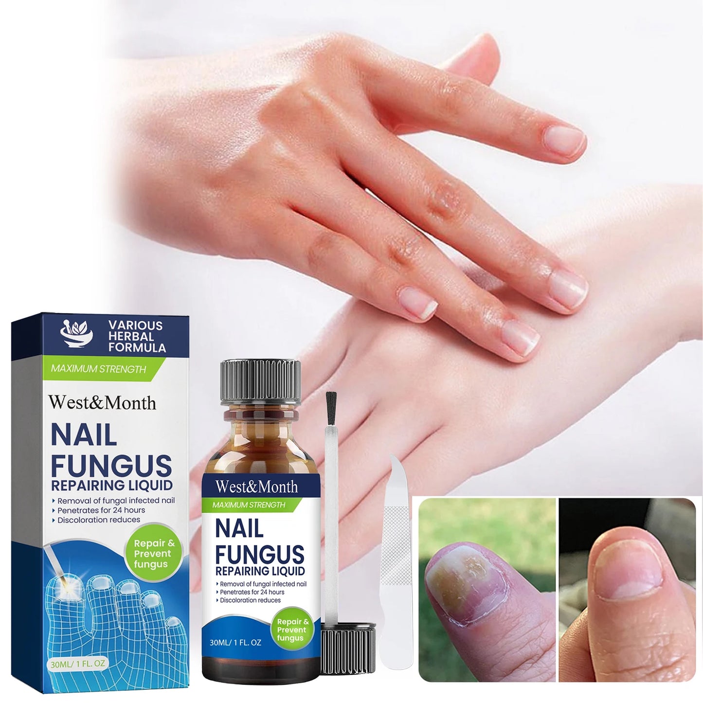 Maximum Strength Nail Fungus Repairing Liquid Removal Infected Thickening Bright Fungal Treatment Medication Soft Hand Foot Care