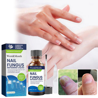 Maximum Strength Nail Fungus Repairing Liquid Removal Infected Thickening Bright Fungal Treatment Medication Soft Hand Foot Care