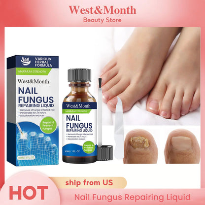 Maximum Strength Nail Fungus Repairing Liquid Removal Infected Thickening Bright Fungal Treatment Medication Soft Hand Foot Care