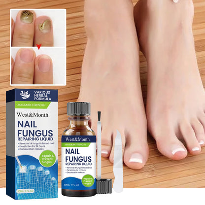 Maximum Strength Nail Fungus Repairing Liquid Removal Infected Thickening Bright Fungal Treatment Medication Soft Hand Foot Care