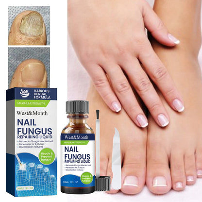 Maximum Strength Nail Fungus Repairing Liquid Removal Infected Thickening Bright Fungal Treatment Medication Soft Hand Foot Care
