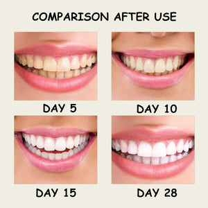 Xylitol Toothpaste Removes Yellow Tartar Cleans Oral Hygiene Freshens Breath Brightens Teeth Care Products, Corrects Tooth Color