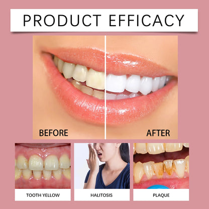 120g Probiotic Toothpaste SP-7 Whitens Teeth Removes Yellow Stains Tooth Whitening Agent Oral Hygiene Cleans and Freshens Breath