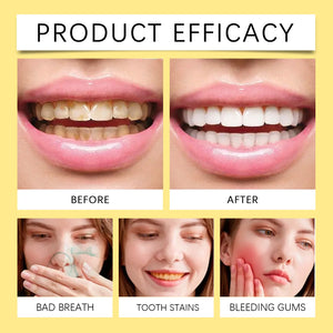 Teeth Cleansing Mousse Removes Smoke Stains Removes Yellowing Freshens Breath Effectively Whitens and Removes Yellowing Oral Car