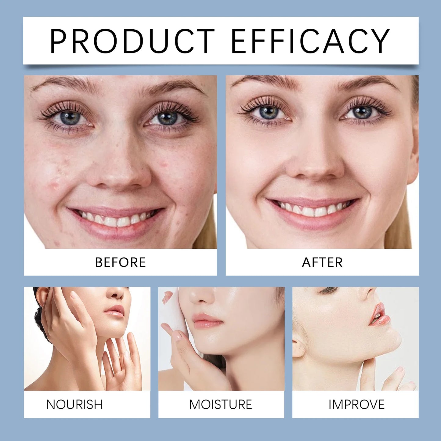 OUHOE Hydrating Care Facial Serum - Deep Moisturize, Balance Oil, Whiten, Repair Acne, All Skin Types, Anti - aging