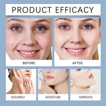 OUHOE Hydrating Care Facial Serum - Deep Moisturize, Balance Oil, Whiten, Repair Acne, All Skin Types, Anti - aging