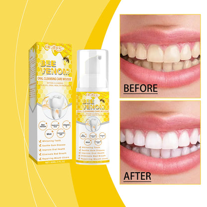 Teeth Cleansing Mousse Removes Smoke Stains Removes Yellowing Freshens Breath Effectively Whitens and Removes Yellowing Oral Car