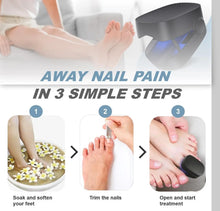 Load image into Gallery viewer, Nail Fungus Cleaning Light Device for Onychomycosis USB Charge 905nm Infrared Light 470nm Blue Light NailSalon Nail Fungus Laser
