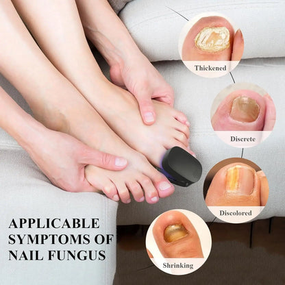 Nail Fungus Cleaning Light Device for Onychomycosis USB Charge 905nm Infrared Light 470nm Blue Light NailSalon Nail Fungus Laser